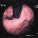 2009年胃カメラ画像-02